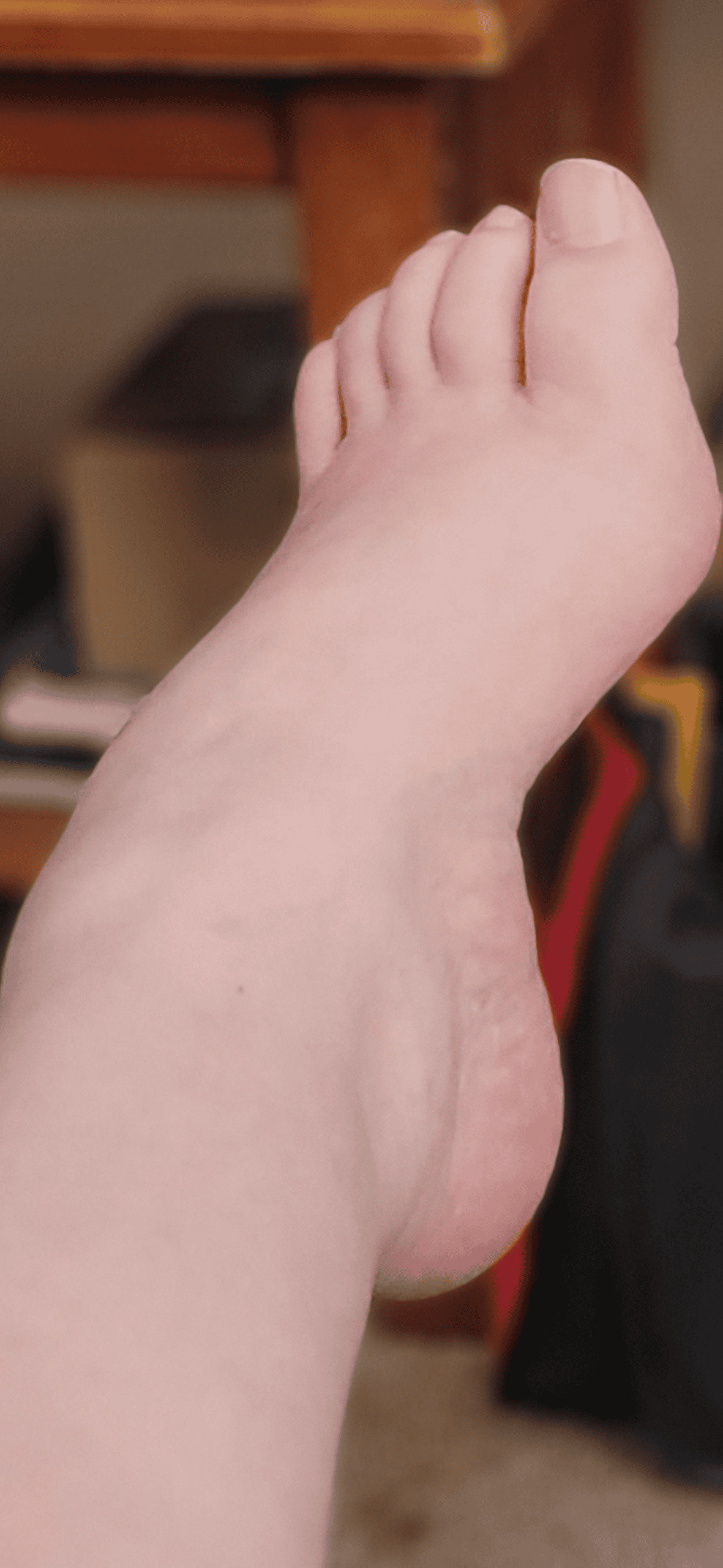 High-arched cavovarus foot deformity caused by Charcot-Marie-Tooth disease (CMT), shown unweighted in side profile.